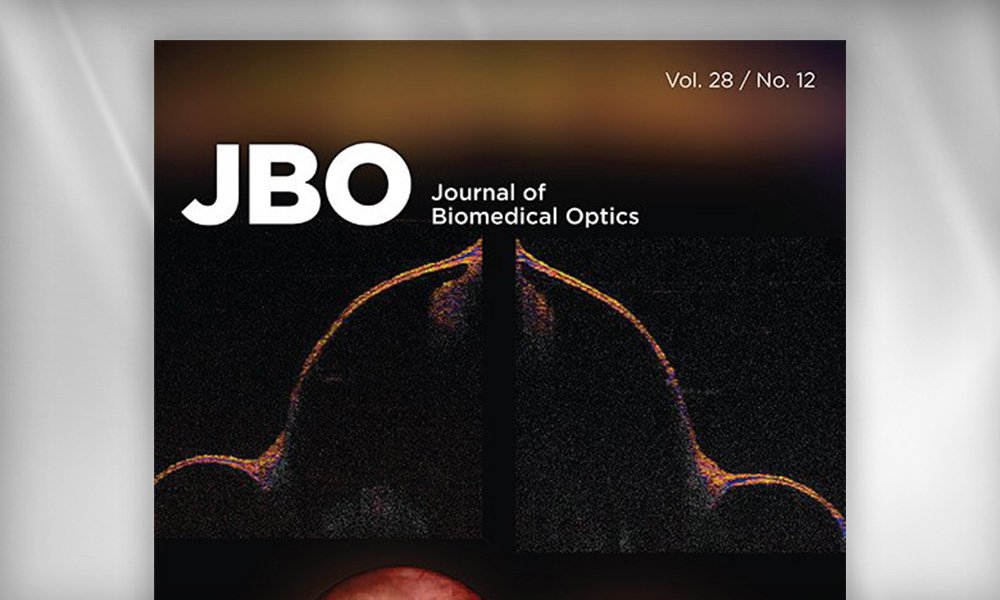 SPIE Journal cover of JBO: Journal of Biomedical Optics showing a high-contrast biomedical imaging scan with curved anatomical structures highlighted in warm colors.