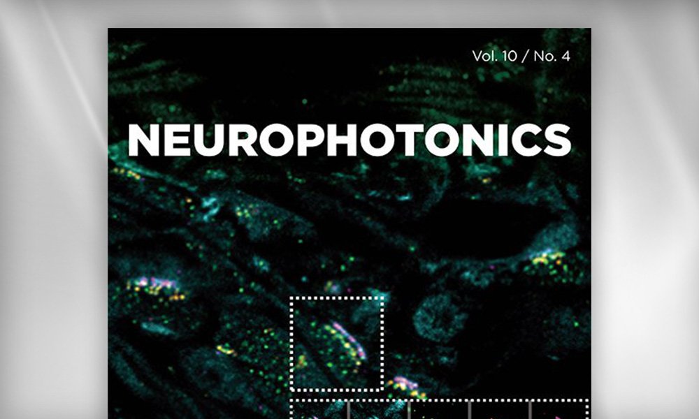 SPIE Journal cover of Neurophotonics showing a dark microscopic image of neural tissue with glowing green and yellow signal clusters, highlighting optical imaging of brain activity.