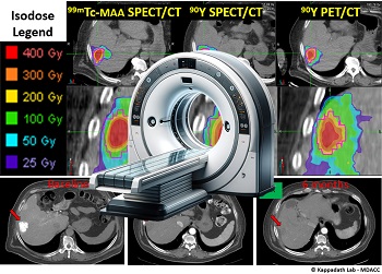 Theranostics; image courtesy of S.C. Kappadath and ChatGPT